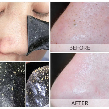 Unisex Blackhead Remove Mask