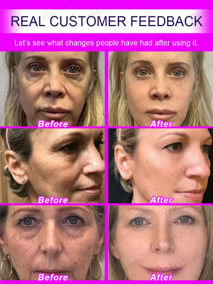 Anti Wrinkle Aging Instant Facial Wrinkles