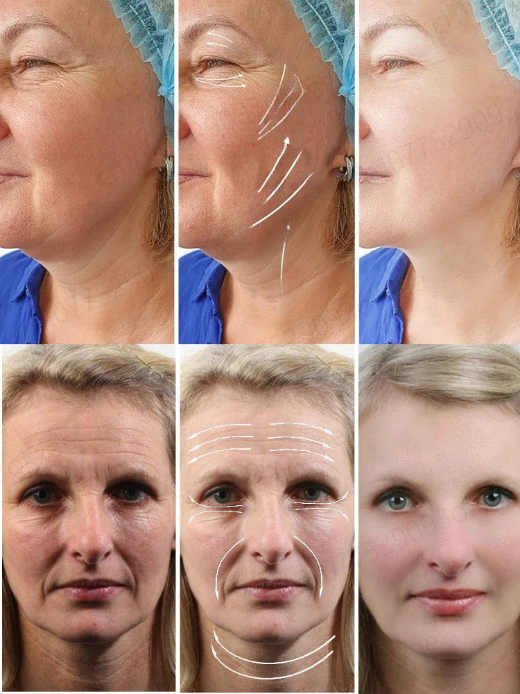 Anti Wrinkle Aging Instant Facial Wrinkles