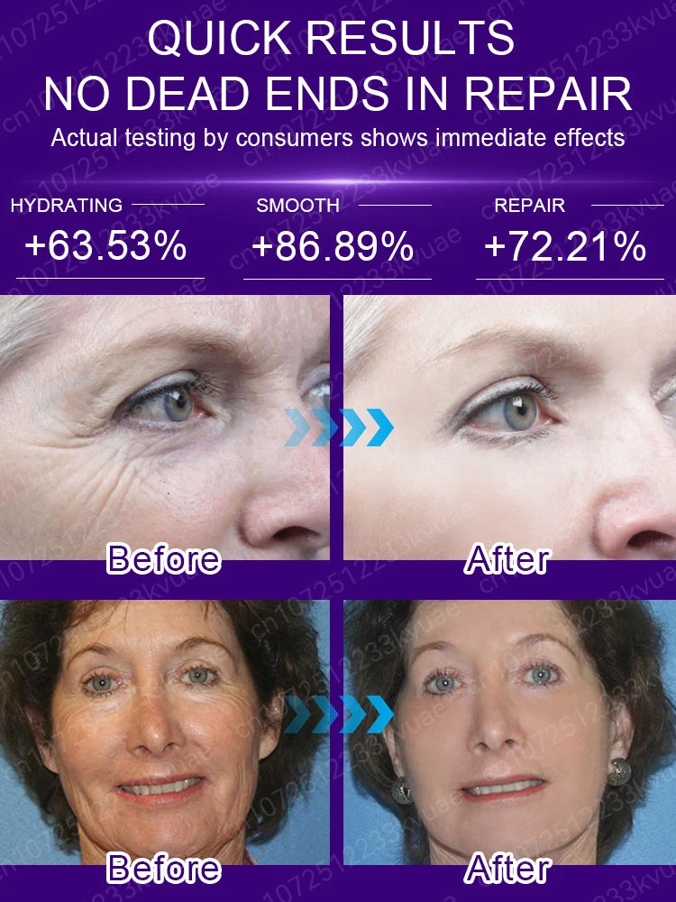 Anti Wrinkle Aging Instant Facial Wrinkles