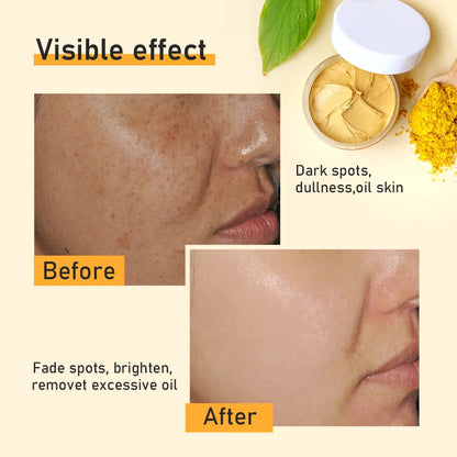 Turmeric Clay Mask Anti Acne Facial Cleansing Beauty